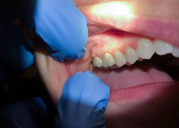 Best Weekend Emergency Dentist in Goodlettsville, TN